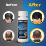 5% Kirkland Minoxidil Liquid - 6 Month Supply - Image 3